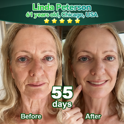 𝐎𝐟𝐟𝐢𝐜𝐢𝐚𝐥𝐥𝐲 𝐀𝐮𝐭𝐡𝐨𝐫𝐢𝐬𝐞𝐝 𝑬𝒙𝒄𝒍𝒖𝒔𝒊𝒗𝒆 𝑬𝒅𝒊𝒕𝒊𝒐𝒏✅𝑇𝑟𝑖𝑙𝑢𝑚𝑖𝑎® 𝖢𝗁𝗅𝗈𝗋𝗈𝗉𝗁𝗒𝗅𝗅 & 𝑆𝑡𝑒𝑚 𝐶𝑒𝑙𝑙 𝖻𝗈𝖽𝗒 𝗋𝖾𝗇𝖾𝗐𝖺𝗅 𝗌𝖾𝗋𝗎𝗆（𝐿𝑖𝑓𝑡 & 𝐹𝑖𝑟𝑚 𝑆𝑎𝑔𝑔𝑖𝑛𝑔 𝑆𝑘𝑖𝑛 & 𝑅𝑒𝑑𝑢𝑐𝑒 𝑊𝑟𝑖𝑛𝑘𝑙𝑒 𝐹𝑜𝑟𝑚𝑎𝑡𝑖𝑜𝑛👍
