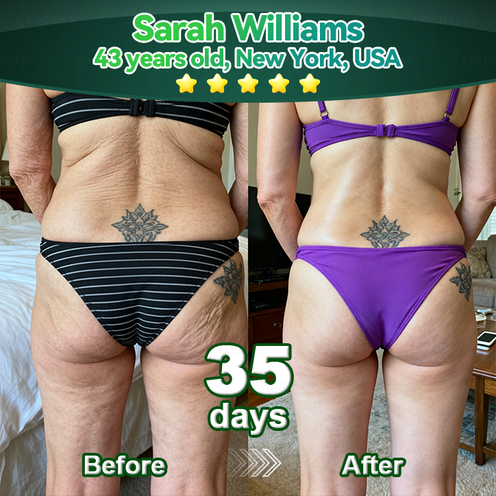 𝐎𝐟𝐟𝐢𝐜𝐢𝐚𝐥𝐥𝐲 𝐀𝐮𝐭𝐡𝐨𝐫𝐢𝐬𝐞𝐝 𝑬𝒙𝒄𝒍𝒖𝒔𝒊𝒗𝒆 𝑬𝒅𝒊𝒕𝒊𝒐𝒏✅Trilumia®𝖢𝗁𝗅𝗈𝗋𝗈𝗉𝗁𝗒𝗅𝗅 & 𝑆𝑡𝑒𝑚 𝐶𝑒𝑙𝑙 𝖻𝗈𝖽𝗒 𝗋𝖾𝗇𝖾𝗐𝖺𝗅 𝗌𝖾𝗋𝗎𝗆（Lift & Firm Sagging Skin & Reduce Wrinkle Formation