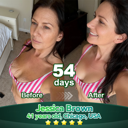 𝐎𝐟𝐟𝐢𝐜𝐢𝐚𝐥𝐥𝐲 𝐀𝐮𝐭𝐡𝐨𝐫𝐢𝐬𝐞𝐝 𝑬𝒙𝒄𝒍𝒖𝒔𝒊𝒗𝒆 𝑬𝒅𝒊𝒕𝒊𝒐𝒏✅Trilumia®𝖢𝗁𝗅𝗈𝗋𝗈𝗉𝗁𝗒𝗅𝗅 & 𝑆𝑡𝑒𝑚 𝐶𝑒𝑙𝑙 𝖻𝗈𝖽𝗒 𝗋𝖾𝗇𝖾𝗐𝖺𝗅 𝗌𝖾𝗋𝗎𝗆（Lift & Firm Sagging Skin & Reduce Wrinkle Formation