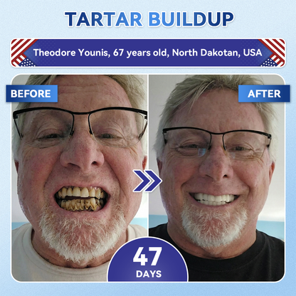 🦷𝑪𝒓𝒆𝒂𝒘𝒆𝒍® 𝐓𝐢𝐝𝐞𝐠𝐥𝐮𝐬𝐢𝐛 𝐓𝐨𝐨𝐭𝐡 & 𝐆𝐮𝐦 𝐑𝐞𝐩𝐚𝐢𝐫 𝐌𝐢𝐜𝐫𝐨𝐧𝐞𝐞𝐝𝐥𝐞 𝐏𝐚𝐭𝐜𝐡  | 𝐀𝐝𝐯𝐚𝐧𝐜𝐞𝐝 𝐒𝐭𝐞𝐦-𝐂𝐞𝐥𝐥 𝐀𝐜𝐭𝐢𝐯𝐚𝐭𝐢𝐨𝐧 𝐓𝐞𝐞𝐭𝐡 𝐒𝐭𝐫𝐢𝐩𝐬(🦷𝐑𝐞𝐛𝐮𝐢𝐥𝐝 𝐄𝐧𝐚𝐦𝐞𝐥 & 𝐃𝐞𝐧𝐭𝐢𝐧 • 𝐒𝐭𝐫𝐞𝐧𝐠𝐭𝐡𝐞𝐧 𝐆𝐮𝐦𝐬 • 𝐄𝐫𝐚𝐝𝐢𝐜𝐚𝐭𝐞 𝐓𝐚𝐫𝐭𝐚𝐫 & 𝐎𝐝𝐨𝐫 • 𝐒𝐭𝐨𝐩 𝐓𝐨𝐨𝐭𝐡 𝐒𝐞𝐧𝐬𝐢𝐭𝐢𝐯𝐢𝐭𝐲)😈