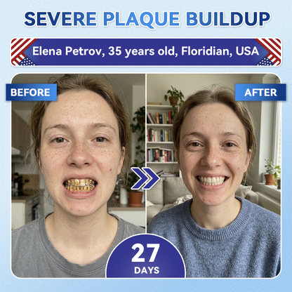🦷𝑪𝒓𝒆𝒂𝒘𝒆𝒍® 𝐓𝐢𝐝𝐞𝐠𝐥𝐮𝐬𝐢𝐛 𝐓𝐨𝐨𝐭𝐡 & 𝐆𝐮𝐦 𝐑𝐞𝐩𝐚𝐢𝐫 𝐌𝐢𝐜𝐫𝐨𝐧𝐞𝐞𝐝𝐥𝐞 𝐏𝐚𝐭𝐜𝐡  | 𝐀𝐝𝐯𝐚𝐧𝐜𝐞𝐝 𝐒𝐭𝐞𝐦-𝐂𝐞𝐥𝐥 𝐀𝐜𝐭𝐢𝐯𝐚𝐭𝐢𝐨𝐧 𝐓𝐞𝐞𝐭𝐡 𝐒𝐭𝐫𝐢𝐩𝐬(🦷𝐑𝐞𝐛𝐮𝐢𝐥𝐝 𝐄𝐧𝐚𝐦𝐞𝐥 & 𝐃𝐞𝐧𝐭𝐢𝐧 • 𝐒𝐭𝐫𝐞𝐧𝐠𝐭𝐡𝐞𝐧 𝐆𝐮𝐦𝐬 • 𝐄𝐫𝐚𝐝𝐢𝐜𝐚𝐭𝐞 𝐓𝐚𝐫𝐭𝐚𝐫 & 𝐎𝐝𝐨𝐫 • 𝐒𝐭𝐨𝐩 𝐓𝐨𝐨𝐭𝐡 𝐒𝐞𝐧𝐬𝐢𝐭𝐢𝐯𝐢𝐭𝐲)😈