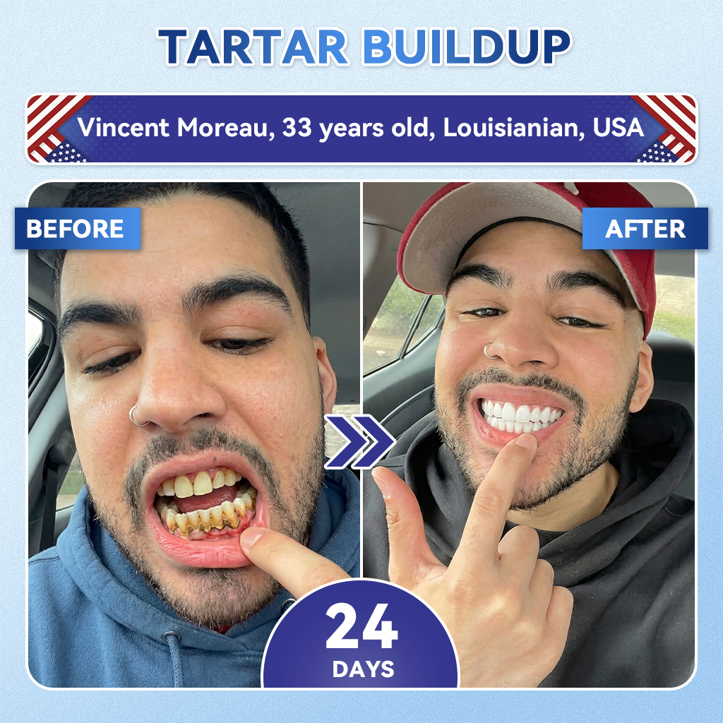🦷𝑪𝒓𝒆𝒂𝒘𝒆𝒍® 𝐓𝐢𝐝𝐞𝐠𝐥𝐮𝐬𝐢𝐛 𝐓𝐨𝐨𝐭𝐡 & 𝐆𝐮𝐦 𝐑𝐞𝐩𝐚𝐢𝐫 𝐌𝐢𝐜𝐫𝐨𝐧𝐞𝐞𝐝𝐥𝐞 𝐏𝐚𝐭𝐜𝐡  | 𝐀𝐝𝐯𝐚𝐧𝐜𝐞𝐝 𝐒𝐭𝐞𝐦-𝐂𝐞𝐥𝐥 𝐀𝐜𝐭𝐢𝐯𝐚𝐭𝐢𝐨𝐧 𝐓𝐞𝐞𝐭𝐡 𝐒𝐭𝐫𝐢𝐩𝐬(🦷𝐑𝐞𝐛𝐮𝐢𝐥𝐝 𝐄𝐧𝐚𝐦𝐞𝐥 & 𝐃𝐞𝐧𝐭𝐢𝐧 • 𝐒𝐭𝐫𝐞𝐧𝐠𝐭𝐡𝐞𝐧 𝐆𝐮𝐦𝐬 • 𝐄𝐫𝐚𝐝𝐢𝐜𝐚𝐭𝐞 𝐓𝐚𝐫𝐭𝐚𝐫 & 𝐎𝐝𝐨𝐫 • 𝐒𝐭𝐨𝐩 𝐓𝐨𝐨𝐭𝐡 𝐒𝐞𝐧𝐬𝐢𝐭𝐢𝐯𝐢𝐭𝐲)😈