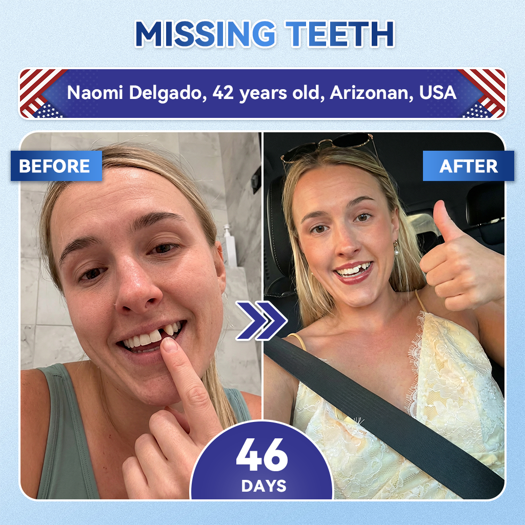🦷𝑪𝒓𝒆𝒂𝒘𝒆𝒍® 𝐓𝐢𝐝𝐞𝐠𝐥𝐮𝐬𝐢𝐛 𝐓𝐨𝐨𝐭𝐡 & 𝐆𝐮𝐦 𝐑𝐞𝐩𝐚𝐢𝐫 𝐌𝐢𝐜𝐫𝐨𝐧𝐞𝐞𝐝𝐥𝐞 𝐏𝐚𝐭𝐜𝐡  | 𝐀𝐝𝐯𝐚𝐧𝐜𝐞𝐝 𝐒𝐭𝐞𝐦-𝐂𝐞𝐥𝐥 𝐀𝐜𝐭𝐢𝐯𝐚𝐭𝐢𝐨𝐧 𝐓𝐞𝐞𝐭𝐡 𝐒𝐭𝐫𝐢𝐩𝐬(🦷𝐑𝐞𝐛𝐮𝐢𝐥𝐝 𝐄𝐧𝐚𝐦𝐞𝐥 & 𝐃𝐞𝐧𝐭𝐢𝐧 • 𝐒𝐭𝐫𝐞𝐧𝐠𝐭𝐡𝐞𝐧 𝐆𝐮𝐦𝐬 • 𝐄𝐫𝐚𝐝𝐢𝐜𝐚𝐭𝐞 𝐓𝐚𝐫𝐭𝐚𝐫 & 𝐎𝐝𝐨𝐫 • 𝐒𝐭𝐨𝐩 𝐓𝐨𝐨𝐭𝐡 𝐒𝐞𝐧𝐬𝐢𝐭𝐢𝐯𝐢𝐭𝐲)😈