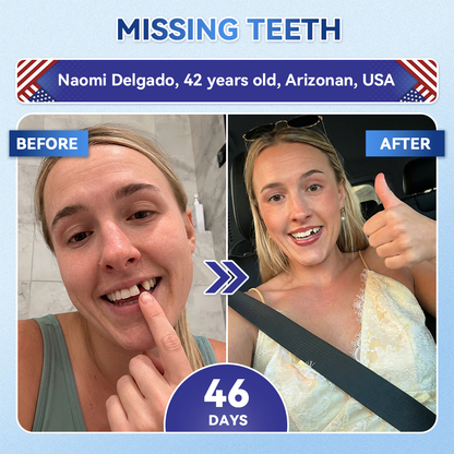 🦷𝑪𝒓𝒆𝒂𝒘𝒆𝒍® 𝐓𝐢𝐝𝐞𝐠𝐥𝐮𝐬𝐢𝐛 𝐓𝐨𝐨𝐭𝐡 & 𝐆𝐮𝐦 𝐑𝐞𝐩𝐚𝐢𝐫 𝐌𝐢𝐜𝐫𝐨𝐧𝐞𝐞𝐝𝐥𝐞 𝐏𝐚𝐭𝐜𝐡  | 𝐀𝐝𝐯𝐚𝐧𝐜𝐞𝐝 𝐒𝐭𝐞𝐦-𝐂𝐞𝐥𝐥 𝐀𝐜𝐭𝐢𝐯𝐚𝐭𝐢𝐨𝐧 𝐓𝐞𝐞𝐭𝐡 𝐒𝐭𝐫𝐢𝐩𝐬(🦷𝐑𝐞𝐛𝐮𝐢𝐥𝐝 𝐄𝐧𝐚𝐦𝐞𝐥 & 𝐃𝐞𝐧𝐭𝐢𝐧 • 𝐒𝐭𝐫𝐞𝐧𝐠𝐭𝐡𝐞𝐧 𝐆𝐮𝐦𝐬 • 𝐄𝐫𝐚𝐝𝐢𝐜𝐚𝐭𝐞 𝐓𝐚𝐫𝐭𝐚𝐫 & 𝐎𝐝𝐨𝐫 • 𝐒𝐭𝐨𝐩 𝐓𝐨𝐨𝐭𝐡 𝐒𝐞𝐧𝐬𝐢𝐭𝐢𝐯𝐢𝐭𝐲)😈