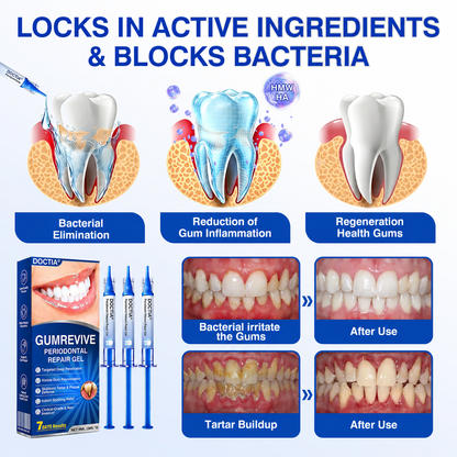 🏅🦷🛡️ DOCTIA® GumRevive Advanced Gum Care & Repair Gel🌞