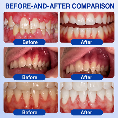 🏅🦷🛡️ DOCTIA® GumRevive Advanced Gum Care & Repair Gel🌞