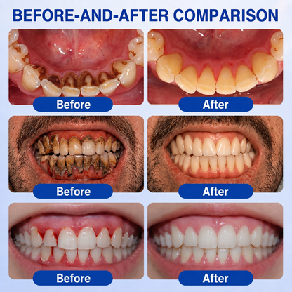 🏅🦷🛡️ DOCTIA® GumRevive Advanced Gum Care & Repair Gel🌞