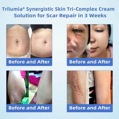 Trilumia® Synergistic Skin Tri-Complex Cream 💎(Copper Peptide+Growth Factors+Methylene Blue)🏆Next-Generation Biotech For Skin Repair